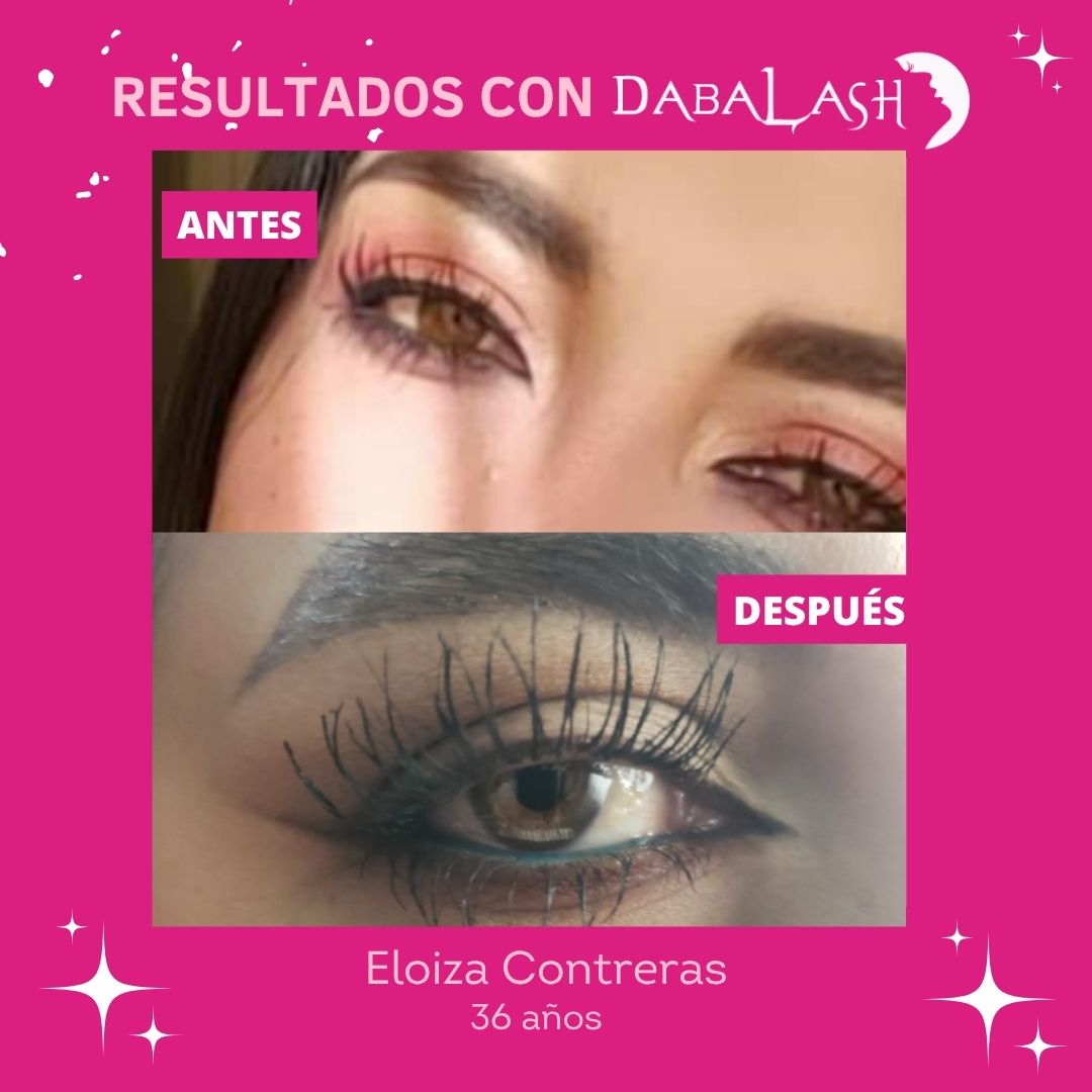Testimonios de crecimiento de pesta&ntilde;as 